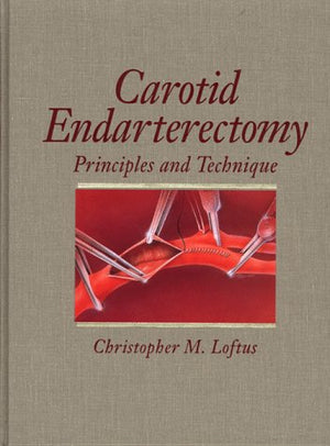 Carotid Endarterectomy: Principles and Technique,Used
