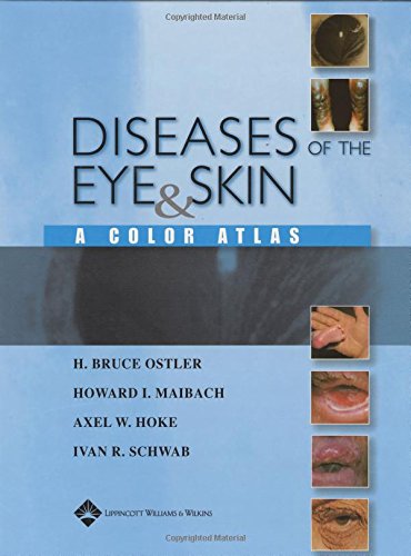 Diseases of the Eye and Skin: A Color Atlas,Used
