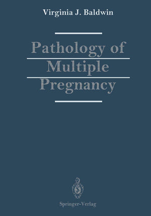 Pathology of Multiple Pregnancy,Used