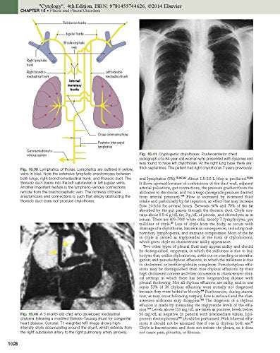 Imaging Of Diseases Of The Chest: Expert Consult  Online And Print