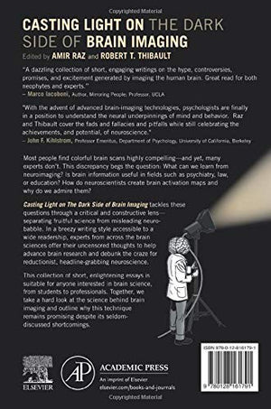 Casting Light on the Dark Side of Brain Imaging,Used