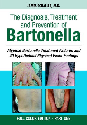 The Diagnosis, Treatment and Prevention of Bartonella: Atypical Bartonella Treatment Failures and 40 Hypothetical Physical Exam ,Used