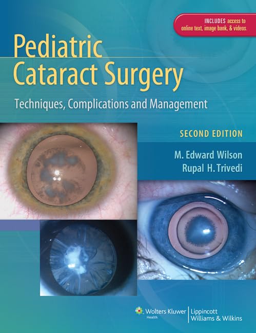 Pediatric Cataract Surgery: Techniques, Complications and Management,New