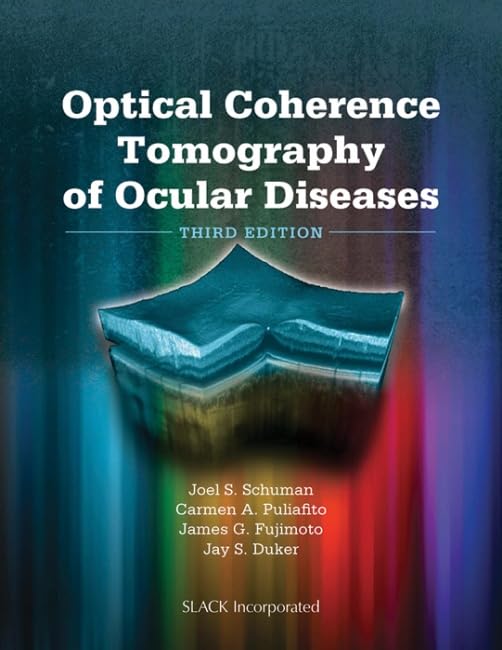 Optical Coherence Tomography Of Ocular Diseases,Used