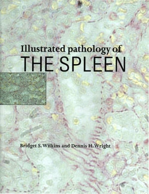 Illustrated Pathology of the Spleen,Used