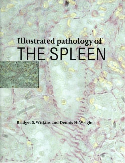Illustrated Pathology of the Spleen,Used