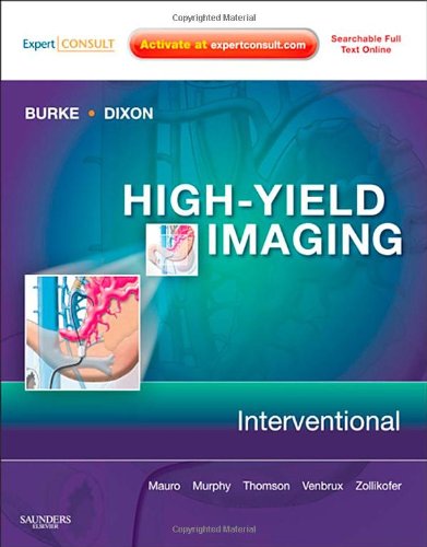 HighYield Imaging: Interventional: Expert Consult  Online and Print (High Yield in Radiology),New