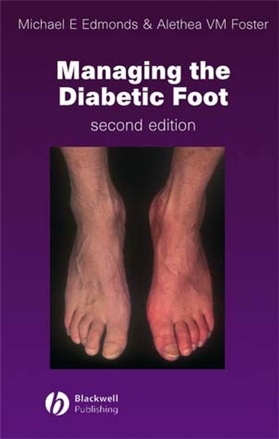 Managing the Diabetic Foot,Used