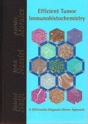 Efficient Tumor Immunohistochemistry,Used