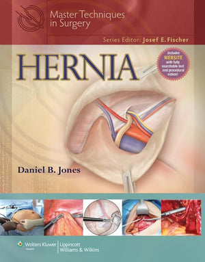 Master Techniques In Surgery: Hernia,Used