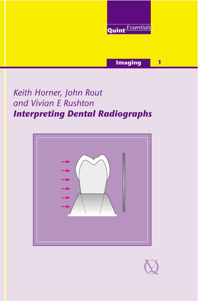 Interpreting Dental Radiographs (Imaging Vol. 1) (Quintessentials of Dental Practice)