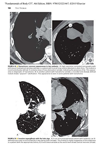 Fundamentals Of Body Ct (Fundamentals Of Radiology)