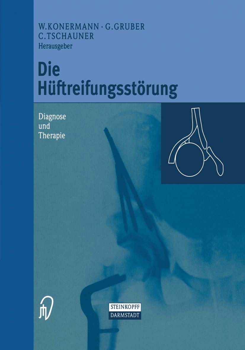 Die Hftreifungsstrung: Diagnose und Therapie (German Edition),New
