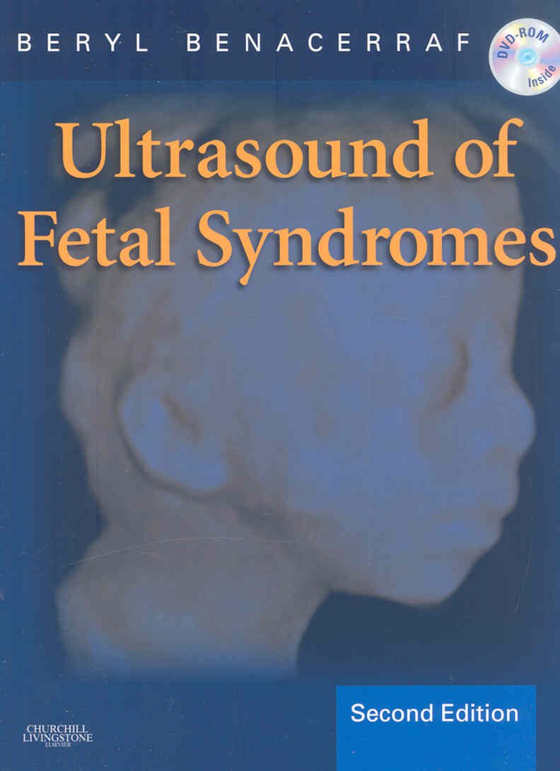 Ultrasound of Fetal Syndromes: Text with DVD
