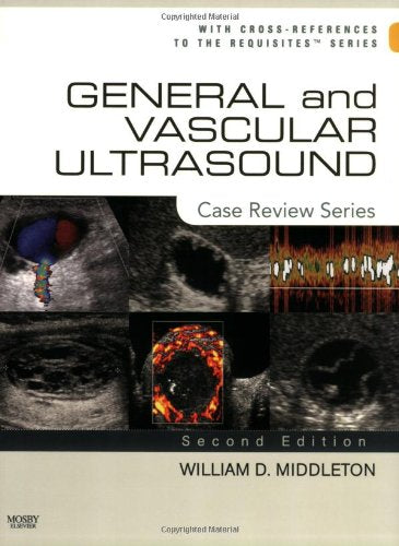 General and Vascular Ultrasound: Case Review Series,Used
