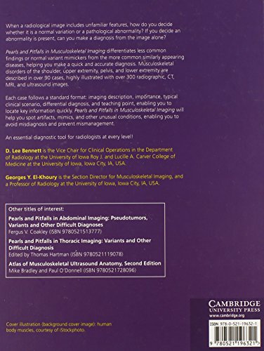 Pearls and Pitfalls in Musculoskeletal Imaging: Variants and Other Difficult Diagnoses,Used