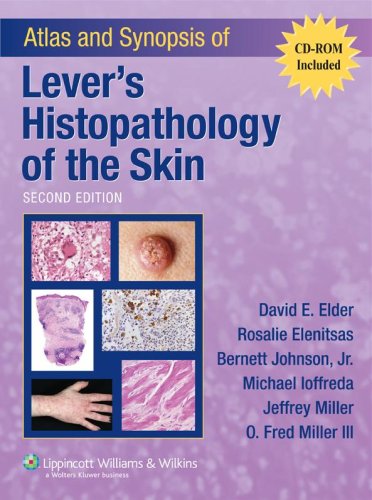 Atlas And Synopsis of Lever's Histopathology of the Skin,Used