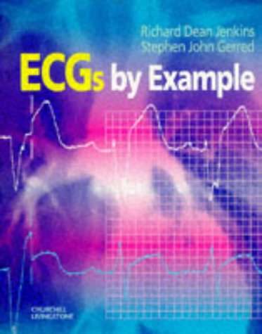 ECGs by Example,Used