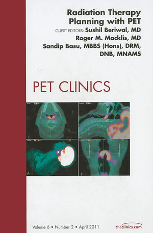 Radiation Therapy Planning With Pet, An Issue Of Pet Clinics (Volume 62) (The Clinics: Radiology, Volume 62),New