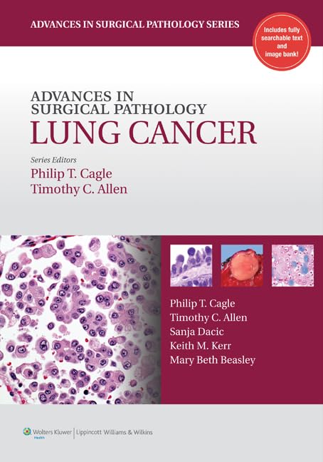 Advances in Surgical Pathology: Lung Cancer (Advances in Surgical Pathology Series),New