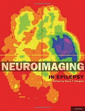 Neuroimaging in Epilepsy,Used