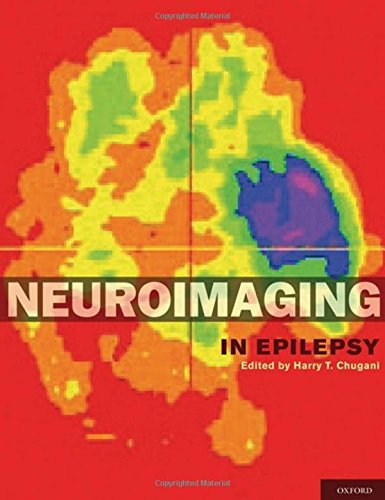 Neuroimaging in Epilepsy,Used