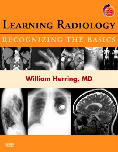 Learning Radiology: Recognizing the Basics (With STUDENT CONSULT Online Access),Used