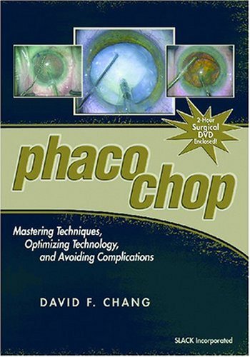 Phaco Chop: Mastering Techniques, Optimizing Technology, and Avoiding Complications,Used
