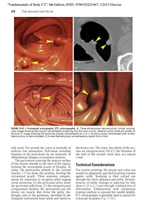Fundamentals Of Body Ct (Fundamentals Of Radiology)