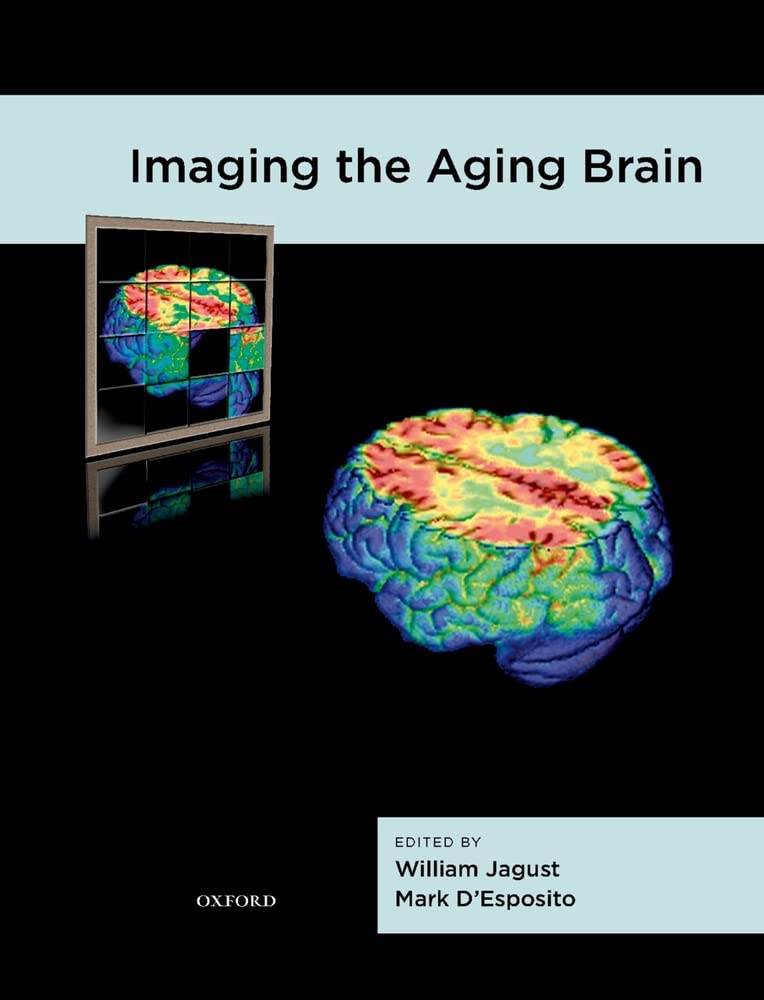 Imaging the Aging Brain,Used