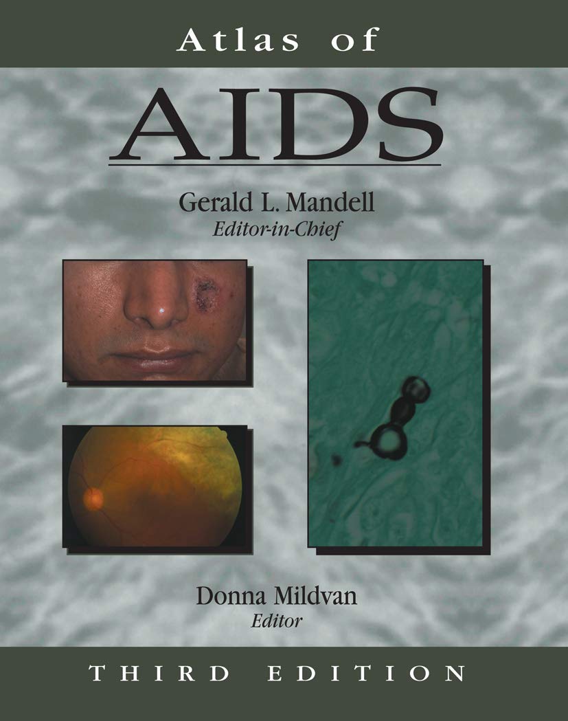 Atlas of AIDS (Atlas of Infectious Diseases (Mandell)),Used