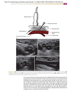 Atlas of Vascular Surgery and Endovascular Therapy,Used