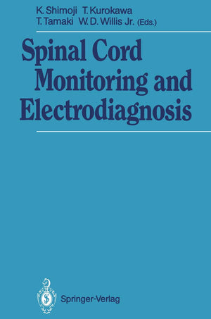 Spinal Cord Monitoring and Electrodiagnosis,Used