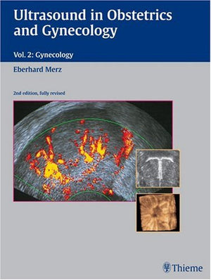 Ultrasound in Obstetrics And Gynecology: Textbook and Atlas, Volume 2  Gynecology
