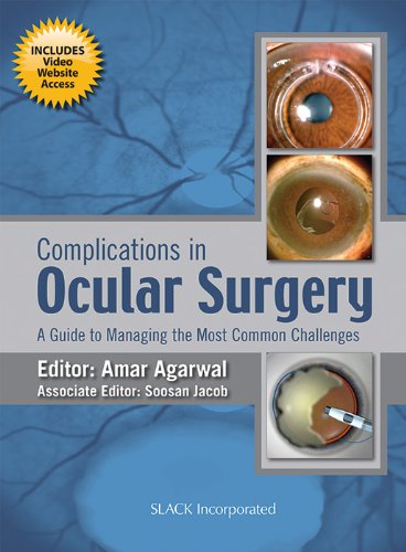 Complications in Ocular Surgery: A Guide to Managing the Most Common Challenges,Used