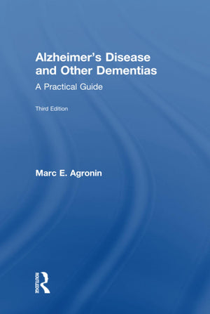 Alzheimer's Disease and Other Dementias,Used