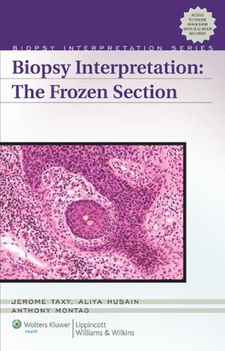 Biopsy Interpretation: The Frozen Section (Biopsy Interpretation Series),New