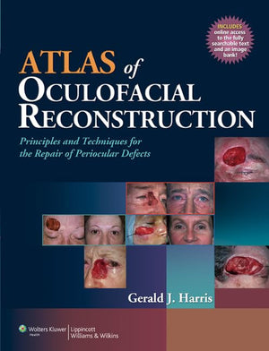 Atlas of Oculofacial Reconstruction: Principles and Techniques for the Repair of Periocular Defects,Used