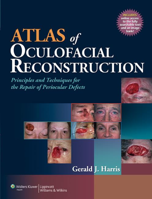 Atlas of Oculofacial Reconstruction: Principles and Techniques for the Repair of Periocular Defects,Used