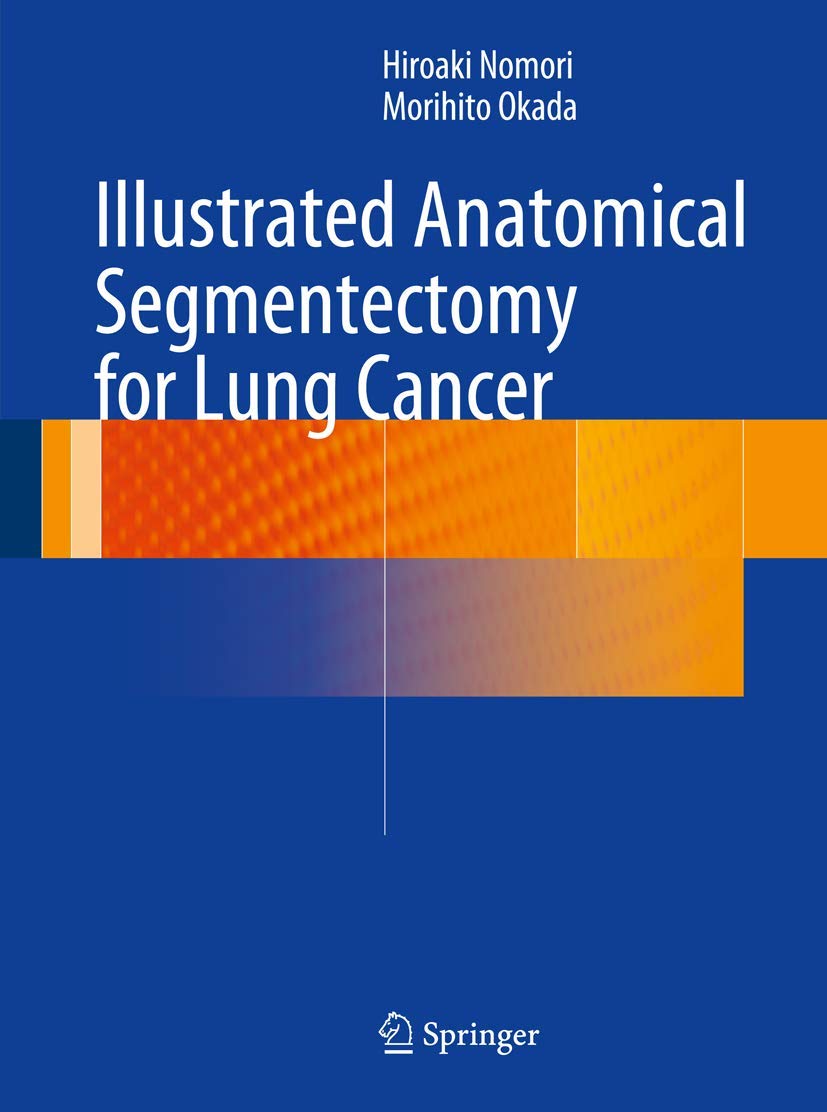 Illustrated Anatomical Segmentectomy for Lung Cancer,Used