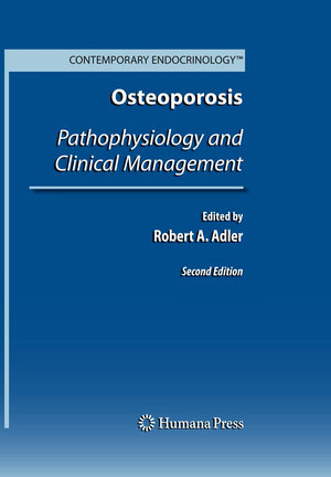 Osteoporosis: Pathophysiology and Clinical Management (Contemporary Endocrinology),Used