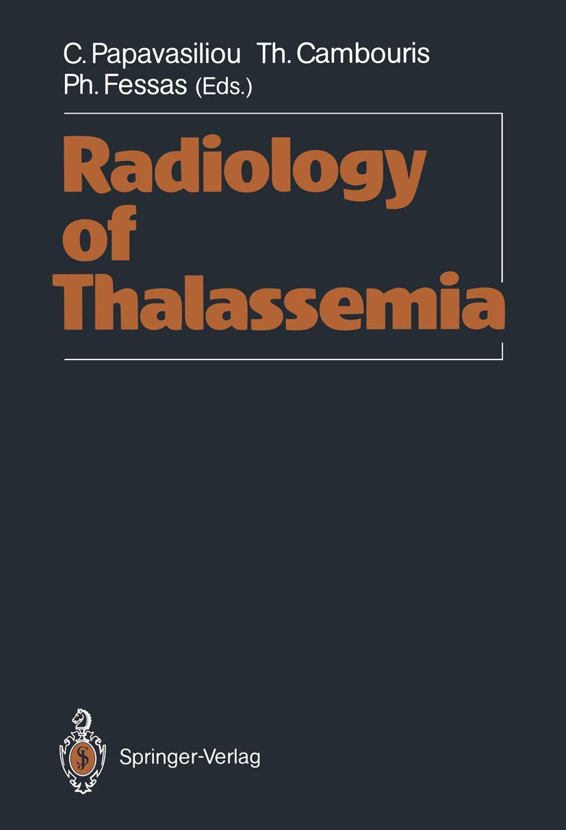 Radiology of Thalassemia,Used