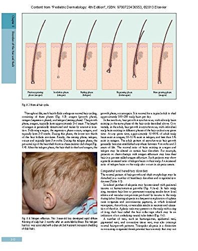 Pediatric Dermatology: Expert Consult  Online and Print (Cohen, Pediatric Dermatology),Used
