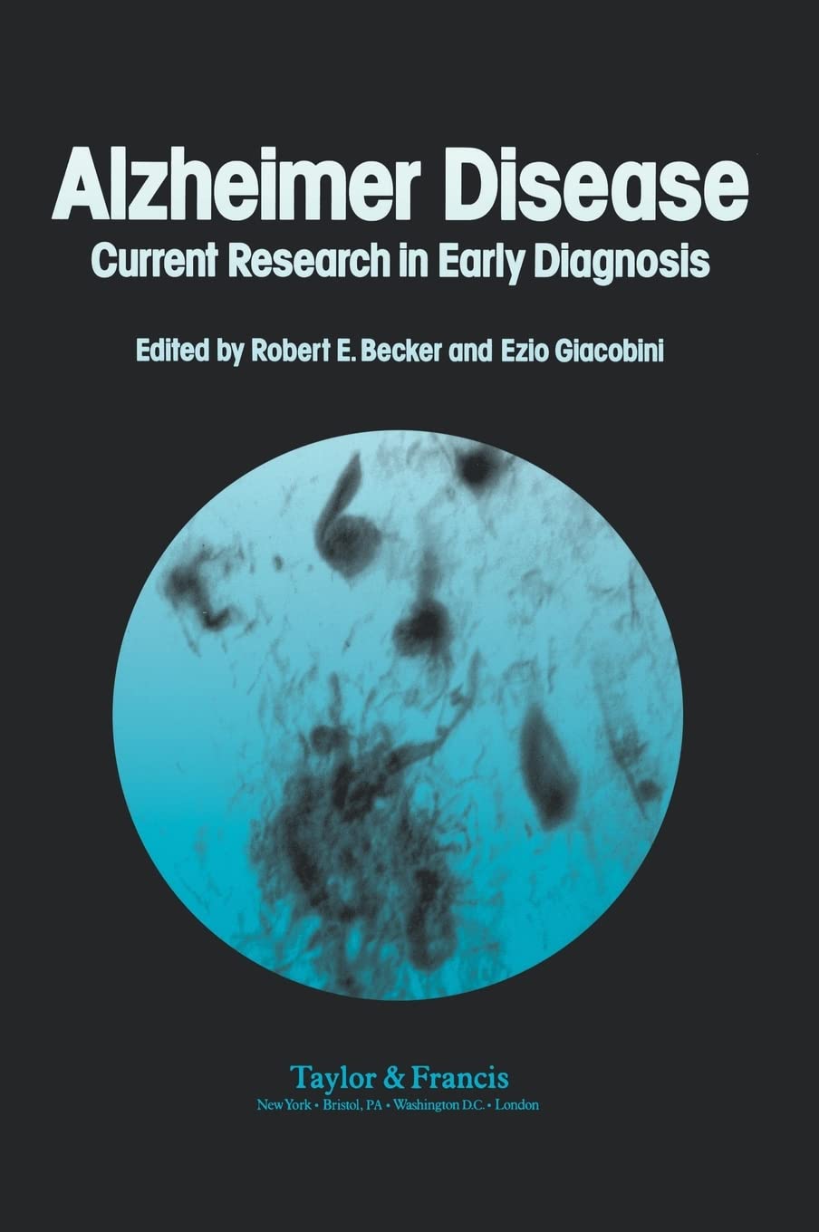 Alzheimer'S Disease: Current Research In Early Diagnosis,Used