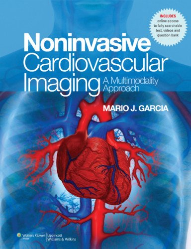 Noninvasive Cardiovascular Imaging: A Multimodality Approach,Used
