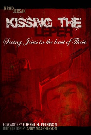 Kissing The Leper: Seeing Jesus In The Least Of These