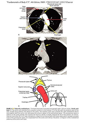 Fundamentals Of Body Ct (Fundamentals Of Radiology)