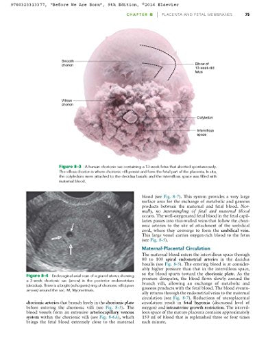 Before We Are Born: Essentials Of Embryology And Birth Defects,New