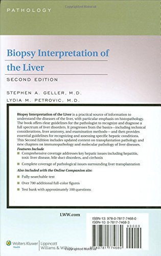 Biopsy Interpretation of the Liver,Used