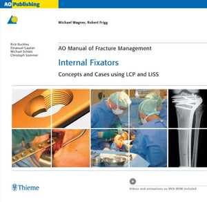 Internal Fixators: Concepts and Cases Using Lcp and Liss (Ao Manual of Fracture Management Series),Used